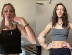 Lengan Bengkak Akibat Penyakit Langka, Banyak Orang di TikTok Minta Gadis Ini Amputasi
